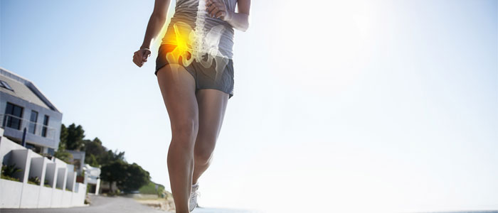 a girl running with sciatica